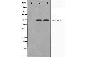 Western blot analysis on A549 and HuvEc cell lysate using TRI18 Antibody. (MID1 抗体  (N-Term))