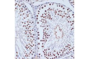 Immunohistochemistry of paraffin-embedded rat testis using DNMT3L antibody (ABIN3023228, ABIN3023229, ABIN3023230 and ABIN6219498) at dilution of 1:100 (40x lens). (DNMT3L 抗体  (AA 1-386))