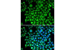 Immunofluorescence analysis of HeLa cells using CFI antibody.