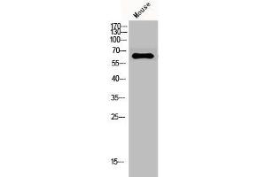 Western Blot analysis of mouse cells using GAD-65/67 Polyclonal Antibody (GAD 抗体  (C-Term))