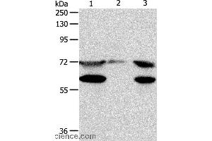 Western blot analysis of Hela cell, mouse testis tissue and Jurkat cell, using SPDL1 Polyclonal Antibody at dilution of 1:400 (CCDC99 抗体)