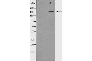 Western blot analysis of extracts of Jurkat, using MED1 antibody. (MED1 抗体  (Internal Region))