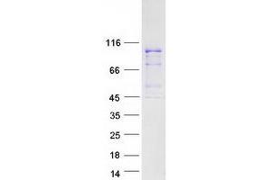 Western Blotting (WB) image for Tuftelin Interacting Protein 11 (TFIP11) (Transcript Variant 1) protein (Myc-DYKDDDDK Tag) (ABIN2733471)