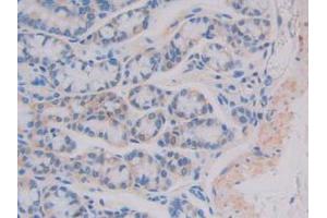 IHC-P analysis of Mouse Intestine Tissue, with DAB staining. (IL11RA 抗体  (AA 194-329))