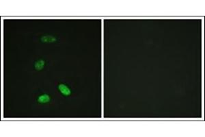Immunofluorescence analysis of HeLa cells, using MYB antibody. (MYB 抗体  (N-Term))