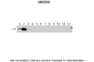 Lanes:   1: 40ng HIS-UBE2D1 protein 2: 40ng HIS-UBE2D2 protein 3: 40ng HIS-UBE2D3 protein 4: 40ng HIS-UBE2D4 protein 5: 40ng HIS-UBE2E1 protein 6: 40ng HIS-UBE2E2 protein 7: 40ng HIS-UBE2E3 protein 8: 40ng HIS-UBE2K protein 9: 40ng HIS-UBE2L3 protein 10: 40ng HIS-UBE2N protein 11: 40ng HIS-UBE2V1 protein 12: 40ng HIS-UBE2V2 protein. (UBE2D2 抗体  (N-Term))