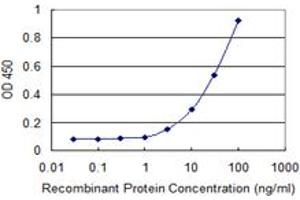 Detection limit for recombinant GST tagged DHRS9 is 1 ng/ml as a capture antibody. (DHRS9 抗体  (AA 1-319))