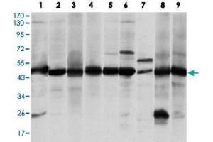 Western blot analysis of ASS1 monoclonal antibody, clone 2B10  against A-431 (1), RAJI (2), L1210 (3), MOLT4 (4), Jurkat (5), A-549 (6), NIH/3T3 (7), PC-12 (8) and COS-7 (9) cell lysate. (ASS1 抗体)