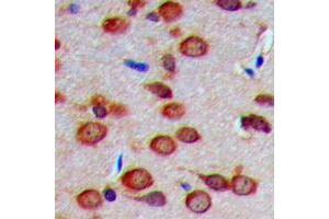 Immunohistochemical analysis of Carbonic Anhydrase 8 staining in human brain formalin fixed paraffin embedded tissue section. (CA8 抗体  (Center))
