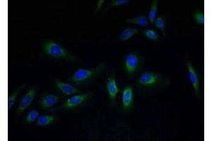 Immunofluorescent analysis of Hela cells using ABIN7173305 at dilution of 1:100 and Alexa Fluor 488-congugated AffiniPure Goat Anti-Rabbit IgG(H+L) (PVRIG 抗体  (AA 193-326))