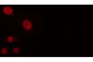 ABIN6274252 staining Hela cells by IF/ICC. (BUD31 抗体  (N-Term))