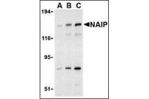 Western blot analysis of NAIP in PC-3 cell lysate with this product at (A) 0. (NAIP 抗体  (C-Term))