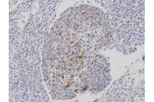IHC-P Image Immunohistochemical analysis of paraffin-embedded human gastric cancer, using CLCA1, antibody at 1:100 dilution. (CLCA1 抗体)