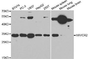 Western Blotting (WB) image for anti-Hepatitis A Virus Cellular Receptor 2 (TIM 3) antibody (ABIN1872939) (TIM3 抗体)