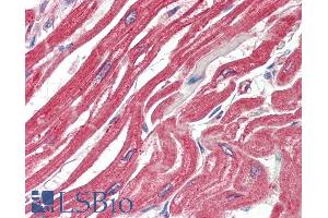 ABIN1590006 (5µg/ml) staining of paraffin embedded Human Heart. (MAPKAP Kinase 2 抗体  (Internal Region))