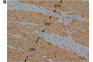 Immunohistochemistry (IHC) image for anti-omega-3 Fatty Acid Receptor 1 (O3FAR1) (N-Term) antibody (ABIN2854731)