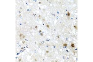 Immunohistochemistry (Paraffin-embedded Sections) (IHC (p)) image for anti-Scaffold Attachment Factor B2 (SAFB2) (AA 1-255) antibody (ABIN1682618)