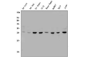 Western blot analysis of CTHRC1 using anti-CTHRC1 antibody (ABIN7601256).