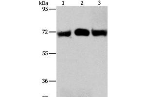 Western Blot analysis of Hela and A549 cell, Human liver cancer tissue using RPN1 Polyclonal Antibody at dilution of 1:350 (RPN1 抗体)