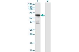 Western Blot analysis of ATE1 expression in transfected 293T cell line by ATE1 monoclonal antibody (M01), clone 2B6. (ATE1 抗体  (AA 1-87))