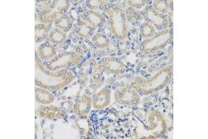 Immunohistochemistry of paraffin-embedded rat kidney using PYCR1 antibody at dilution of 1:200 (40x lens). (PYCR1 抗体)