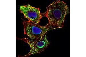 Immunofluorescence analysis of NIH/3T3 cells using SMAD3 mouse mAb (green). (SMAD3 抗体)