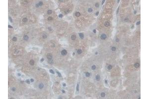 Immunohistochemistry (IHC) image for anti-NADPH Oxidase 5 (NOX5) (AA 456-765) antibody (ABIN7444193)