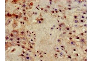 Immunohistochemistry of paraffin-embedded human placenta tissue using ABIN7156486 at dilution of 1:100 (Integrin beta 4 抗体  (AA 1401-1533))
