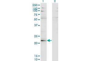 Western Blot analysis of LBX2 expression in transfected 293T cell line by LBX2 monoclonal antibody (M02), clone 3A5. (LBX2 抗体  (AA 95-194))