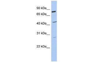 WB Suggested Anti-CCDC63 Antibody Titration: 0. (CCDC63 抗体  (Middle Region))
