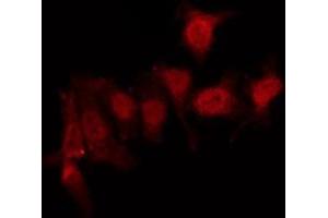 ABIN6275959 staining Hela by IF/ICC. (GPR152 抗体  (N-Term))