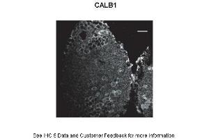 Primary Antibody Dilution: 1:500Secondary Antibody: Donkey anti-rabbit Alexa 488 Secondary Antibody Dilution: 1:000  Gene Name: CALB1 Submitted by: Anonymous (CALB1 抗体  (C-Term))