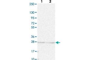 Western blot analysis of Lane 1: Human cell line RT-4 Lane 2: Human cell line U-251MG sp with KPNA1 polyclonal antibody  at 1:250-1:500 dilution. (KPNA1 抗体)