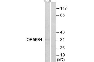 Western Blotting (WB) image for anti-Olfactory Receptor, Family 56, Subfamily B, Member 4 (OR56B4) (C-Term) antibody (ABIN1853150) (OR56B4 抗体  (C-Term))