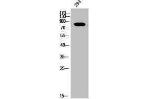 Western Blot analysis of 293 cells using Phospho-Insulin R (Y1361) Polyclonal Antibody (Insulin Receptor 抗体  (pTyr1361))