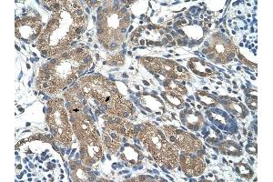 C21ORF7 antibody was used for immunohistochemistry at a concentration of 4-8 ug/ml to stain Epithelial cells of renal tubule (arrows) in Human Kidney.