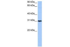 WB Suggested Anti-PRDX3 Antibody Titration: 0. (Peroxiredoxin 3 抗体  (N-Term))