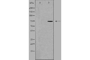 Western blot analysis of extracts from COLO205 cells, using HLX1 antibody. (HLX 抗体  (Internal Region))