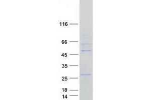 Western Blotting (WB) image for Origin Recognition Complex, Subunit 4 (ORC4) (Transcript Variant 2) protein (Myc-DYKDDDDK Tag) (ABIN2727928)