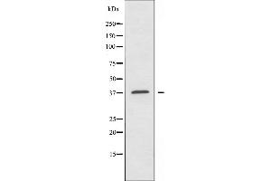 Western blot analysis of extracts from HeLa cells using TUSC3 antibody. (TUSC3 抗体  (Internal Region))