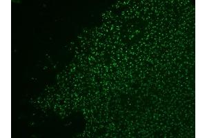 Formalin-fixed, paraffin-embedded human colol carcinoma stained with AF488-conjugated Nucleolin MAb (364-5 + NCL/902). (Nucleolin 抗体)