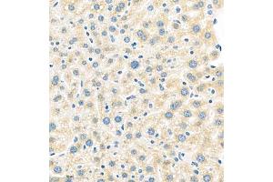 Immunohistochemistry of paraffin embedded mouse liver using MUC20 (ABIN7074692) at dilution of 1:1000 (400x lens) (MUC20 抗体)
