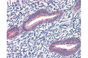 Immunohistochemistry (IHC) image for anti-Twist Homolog 1 (Drosophila) (TWIST1) (C-Term) antibody (ABIN2780347) (TWIST1 抗体  (C-Term))