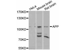 Western blot analysis of extracts of various cell lines, using APP antibody (ABIN5997248) at 1/1000 dilution. (APP 抗体)