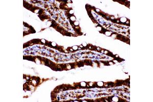Anti-Caspase3 antibody, IHC(P) IHC(P): Rat Intestine Tissue (Caspase 3 抗体  (AA 67-175))