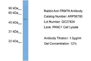 WB Suggested Anti-TRMT6  Antibody Titration: 0. (TRMT6 抗体  (Middle Region))
