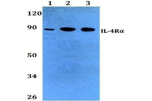 Western Blot (WB) analysis of CD124 / IL4R antibody at 1/500 dilution. (IL4 Receptor 抗体)