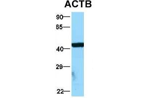 Western Blotting (WB) image for anti-Actin, beta (ACTB) (Middle Region) antibody (ABIN2778644)