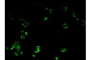 Detection of PRDX6 in Human Hela Cells using Polyclonal Antibody to Peroxiredoxin 6 (PRDX6) (Peroxiredoxin 6 抗体  (AA 1-224))