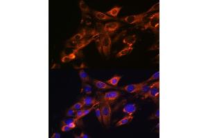 Immunofluorescence analysis of NIH-3T3 cells using Src Rabbit mAb (ABIN7269727) at dilution of 1:100 (40x lens). (Src 抗体)